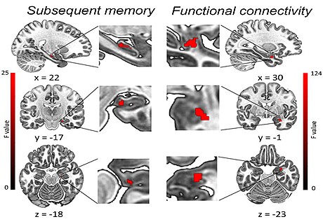 Functional Coupling
